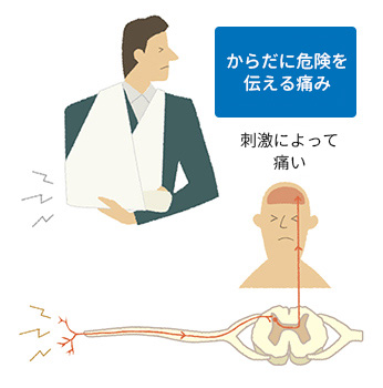 からだに危険を伝える痛みや炎症による痛み